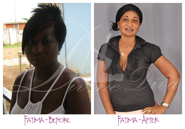 Fatima before and after